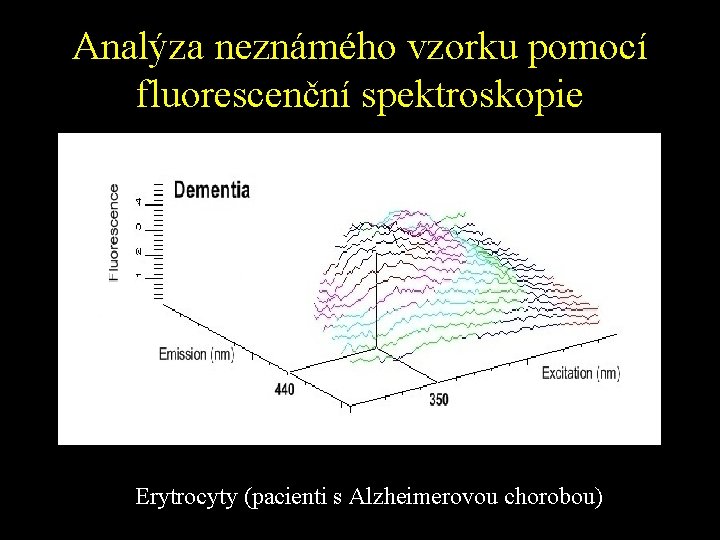 Analýza neznámého vzorku pomocí fluorescenční spektroskopie Erytrocyty (pacienti s Alzheimerovou chorobou) 