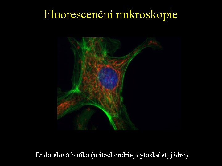 Fluorescenční mikroskopie Endotelová buňka (mitochondrie, cytoskelet, jádro) 