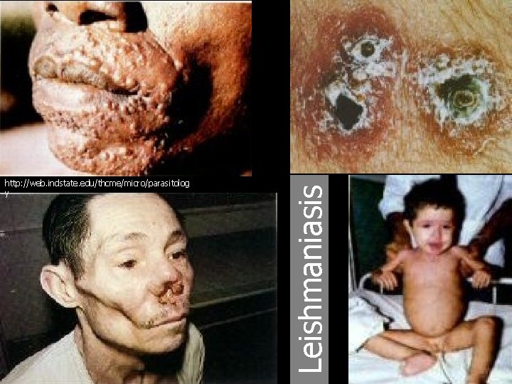 Leishmaniasis http: //web. indstate. edu/thcme/micro/parasitolog y 