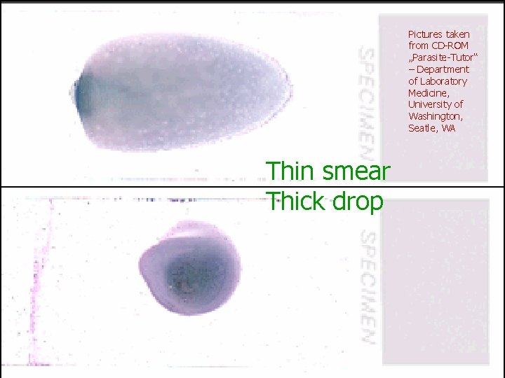 Pictures taken from CD-ROM „Parasite-Tutor“ – Department of Laboratory Medicine, University of Washington, Seatle,