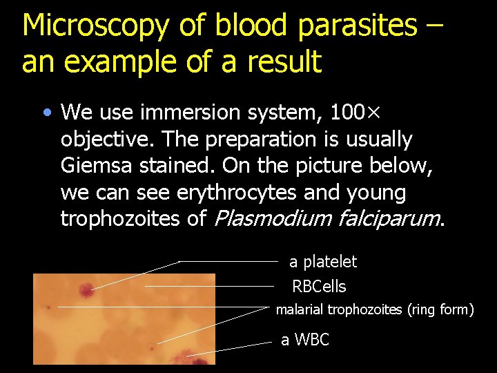 Microscopy of blood parasites – an example of a result • We use immersion