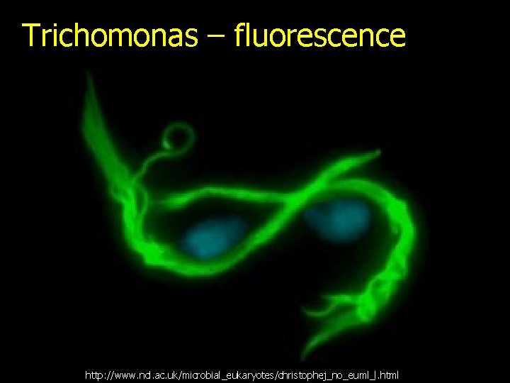 Trichomonas – fluorescence http: //www. ncl. ac. uk/microbial_eukaryotes/christophej_no_euml_l. html 