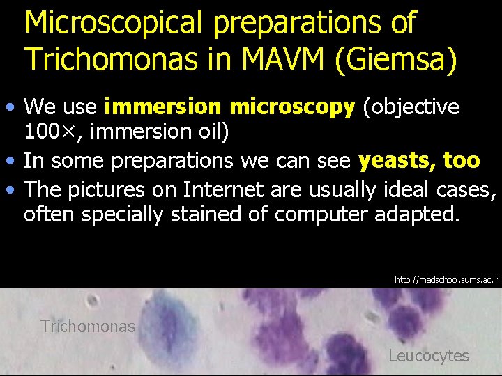 Microscopical preparations of Trichomonas in MAVM (Giemsa) • We use immersion microscopy (objective 100×,