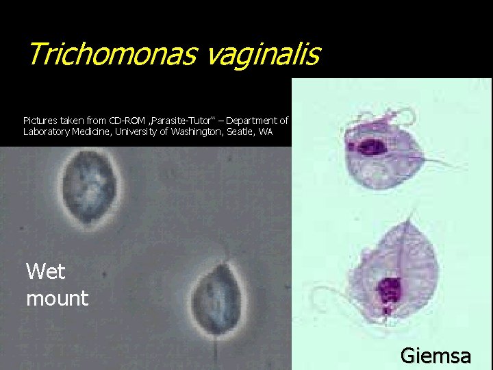 Trichomonas vaginalis Pictures taken from CD-ROM „Parasite-Tutor“ – Department of Laboratory Medicine, University of