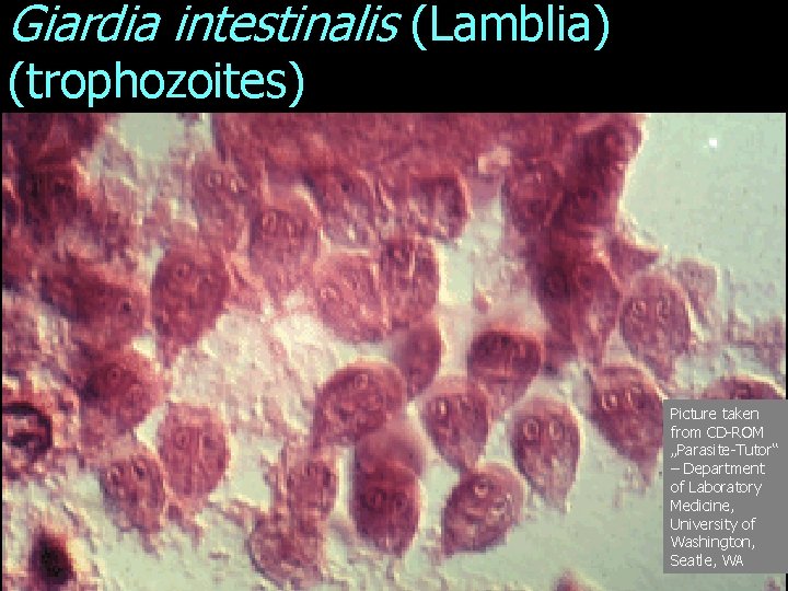 Giardia intestinalis (Lamblia) (trophozoites) Picture taken from CD-ROM „Parasite-Tutor“ – Department of Laboratory Medicine,