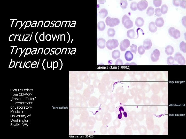Trypanosoma cruzi (down), Trypanosoma brucei (up) Pictures taken from CD-ROM „Parasite-Tutor“ – Department of