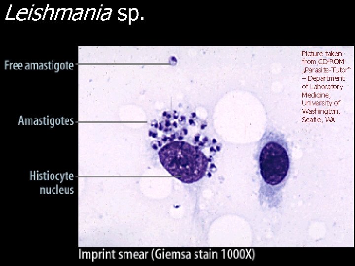 Leishmania sp. Picture taken from CD-ROM „Parasite-Tutor“ – Department of Laboratory Medicine, University of