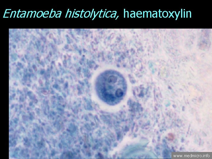 Entamoeba histolytica, haematoxylin www. medmicro. info 