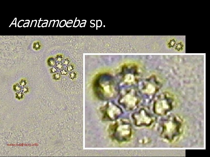Acantamoeba sp. www. medmicro. info 