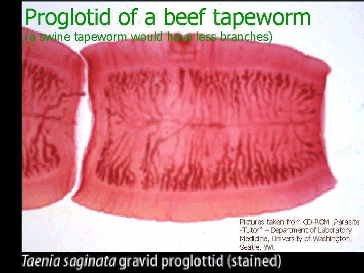 Proglotid of a beef tapeworm (a swine tapeworm would have less branches) Pictures taken