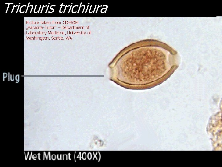 Trichuris trichiura Picture taken from CD-ROM „Parasite-Tutor“ – Department of Laboratory Medicine, University of