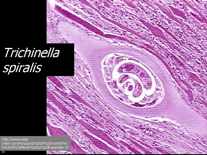 Trichinella spiralis http: //www. medchem. com/Para/prob%20 of%20 month/Pro b%20 of%20 Month%2012%20 December. ht m