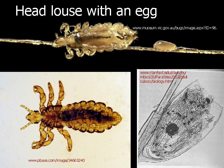Head louse with an egg www. museum. vic. gov. au/bugs/image. aspx? ID=96. www. stanford.