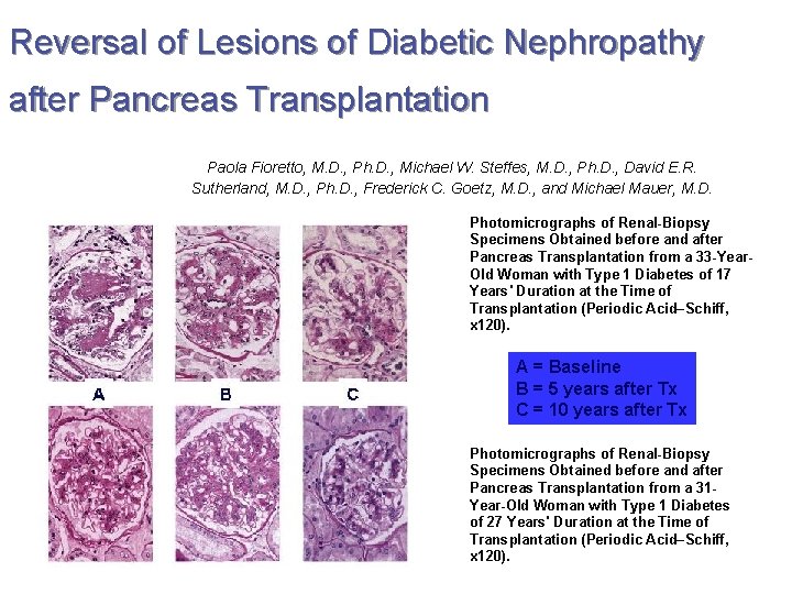 Reversal of Lesions of Diabetic Nephropathy after Pancreas Transplantation Paola Fioretto, M. D. ,