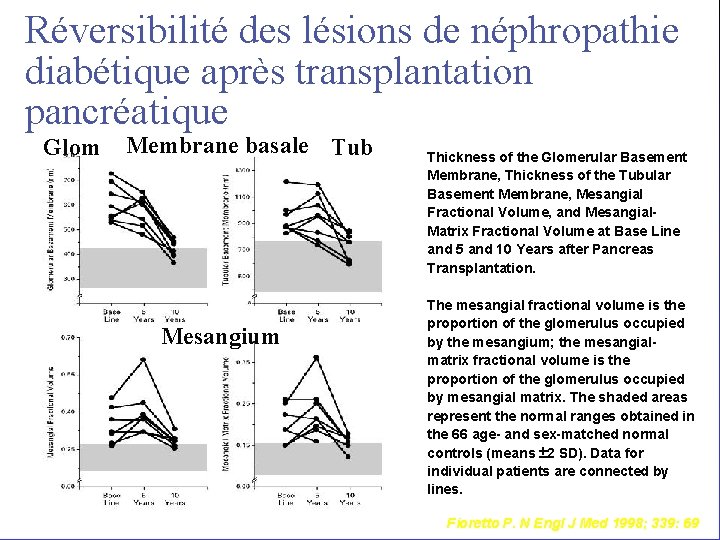 Réversibilité des lésions de néphropathie diabétique après transplantation pancréatique Glom Membrane basale Tub Mesangium