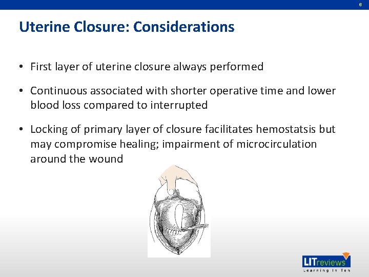 6 Uterine Closure: Considerations • First layer of uterine closure always performed • Continuous