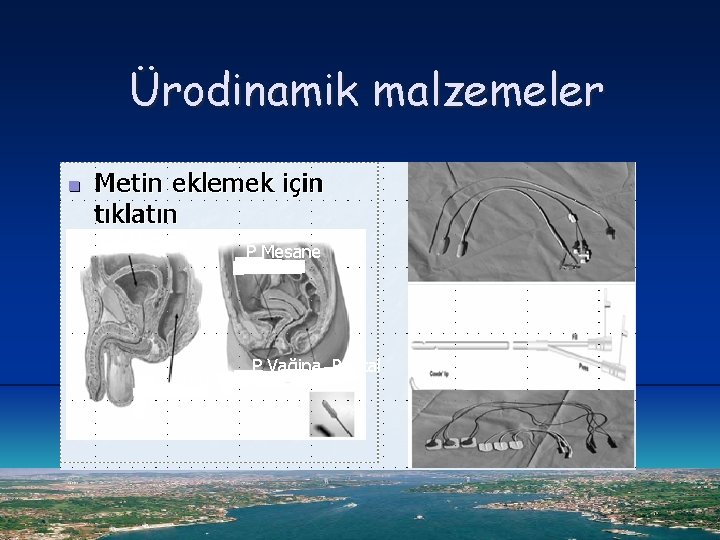 Ürodinamik malzemeler P Mesane P Rektal P Mesane P Vağina Rektal 