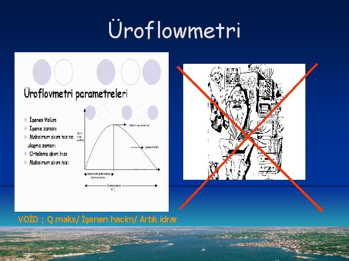 Üroflowmetri VOİD ; Q maks/ İşenen hacim/ Artık idrar 