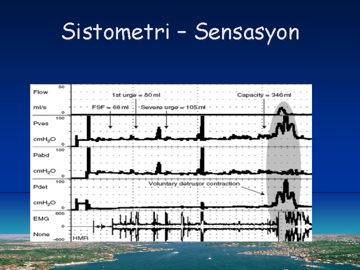 Sistometri – Sensasyon 