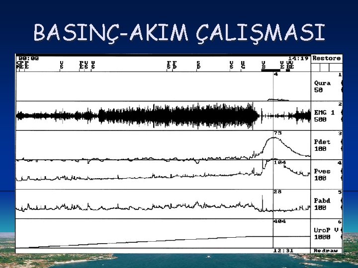 BASINÇ-AKIM ÇALIŞMASI 