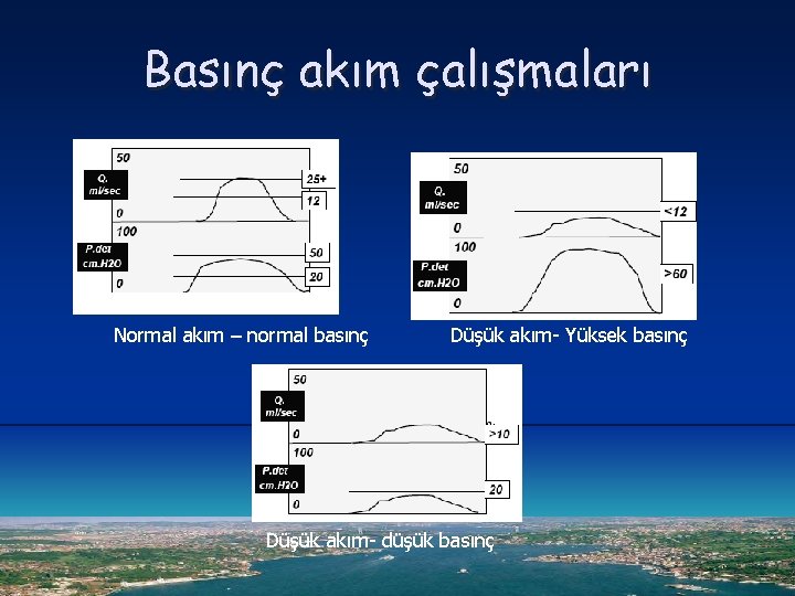 Basınç akım çalışmaları Normal akım – normal basınç Düşük akım- Yüksek basınç Düşük akım-