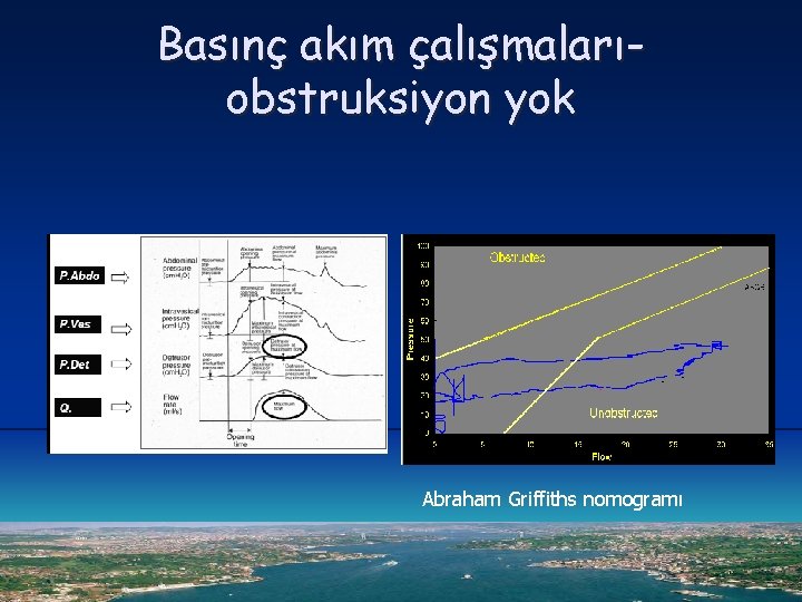 Basınç akım çalışmalarıobstruksiyon yok Abraham Griffiths nomogramı 