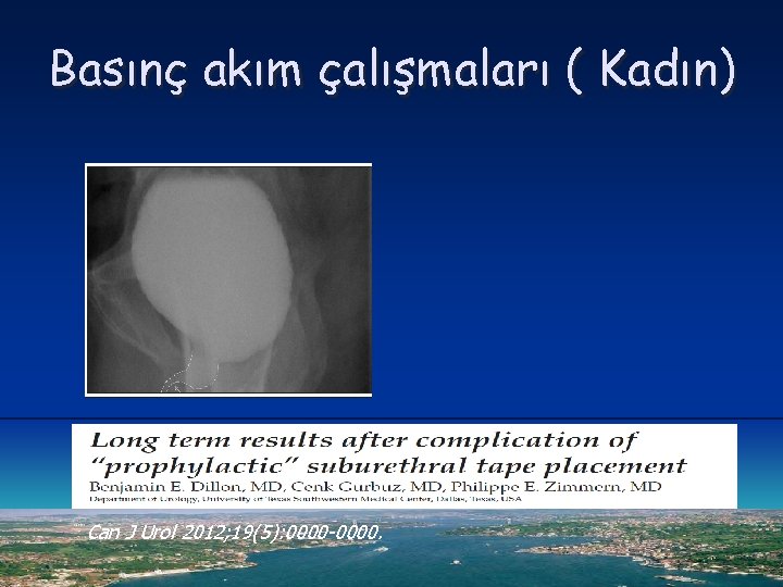 Basınç akım çalışmaları ( Kadın) Can J Urol 2012; 19(5): 0000 -0000. 