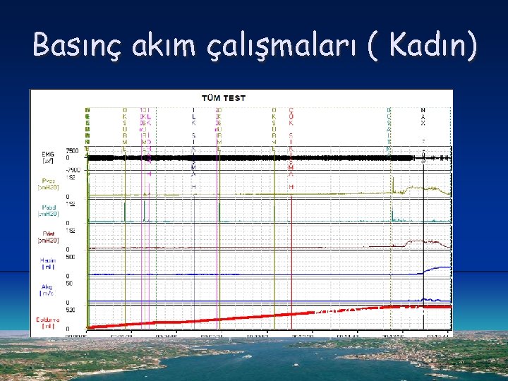 Basınç akım çalışmaları ( Kadın) Pdet /Q maks: 54/8 