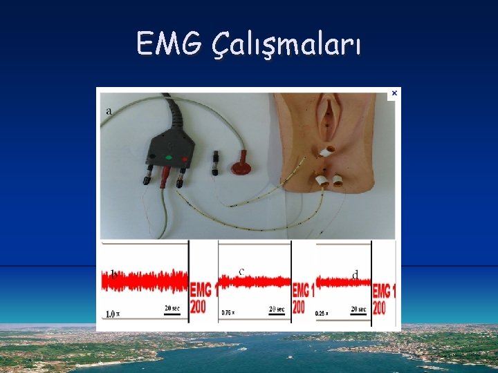 EMG Çalışmaları 