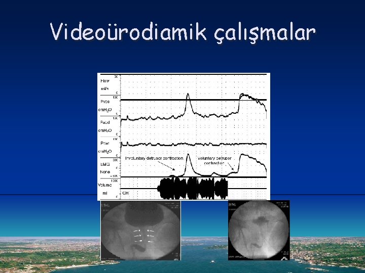 Videoürodiamik çalışmalar 