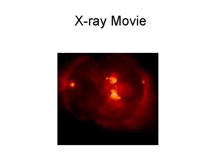 X-ray Movie 