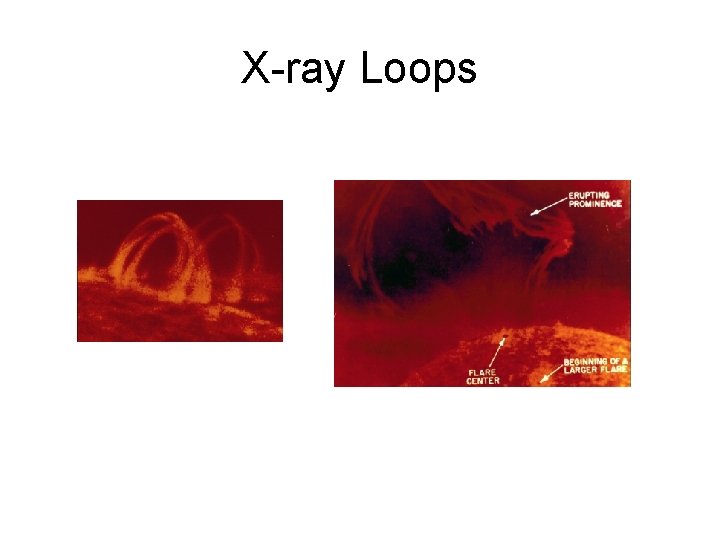 X-ray Loops 