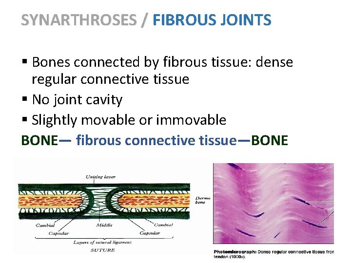 SYNARTHROSES / FIBROUS JOINTS § Bones connected by fibrous tissue: dense regular connective tissue SYNARTHROSES / FIBROUS JOINTS § Bones connected by fibrous tissue: dense regular connective tissue