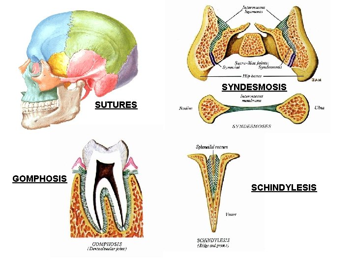 SYNDESMOSIS SUTURES GOMPHOSIS SCHINDYLESIS SYNDESMOSIS SUTURES GOMPHOSIS SCHINDYLESIS