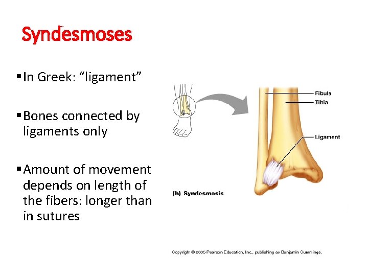 Syndesmoses §In Greek: “ligament” §Bones connected by ligaments only §Amount of movement depends on Syndesmoses §In Greek: “ligament” §Bones connected by ligaments only §Amount of movement depends on