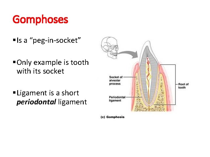 Gomphoses §Is a “peg-in-socket” §Only example is tooth with its socket §Ligament is a Gomphoses §Is a “peg-in-socket” §Only example is tooth with its socket §Ligament is a