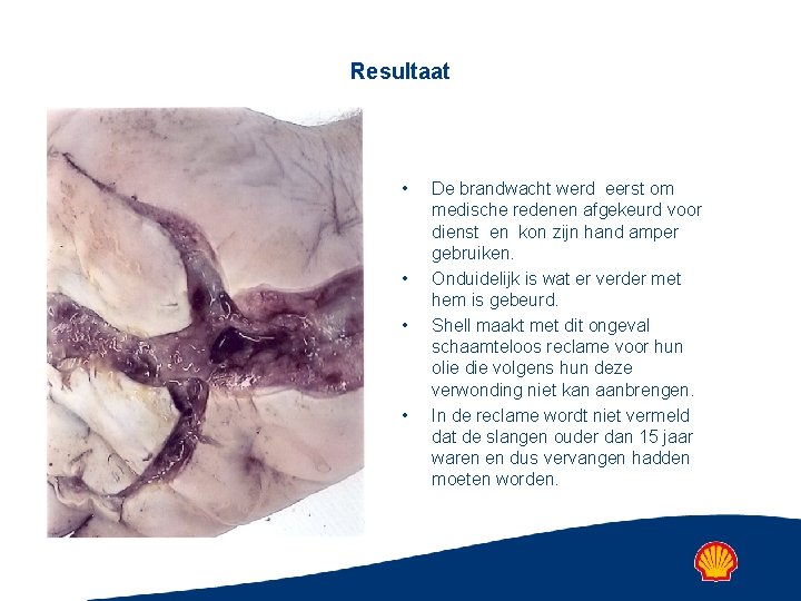 Resultaat • • De brandwacht werd eerst om medische redenen afgekeurd voor dienst en