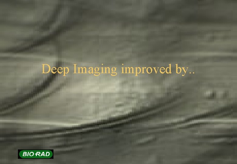 Deep Imaging improved by. . 