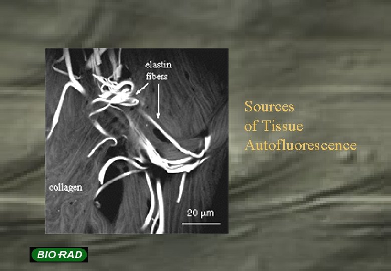 Sources of Tissue Autofluorescence 