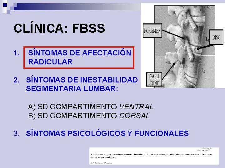 CLÍNICA: FBSS 1. SÍNTOMAS DE AFECTACIÓN RADICULAR 2. SÍNTOMAS DE INESTABILIDAD SEGMENTARIA LUMBAR: A)