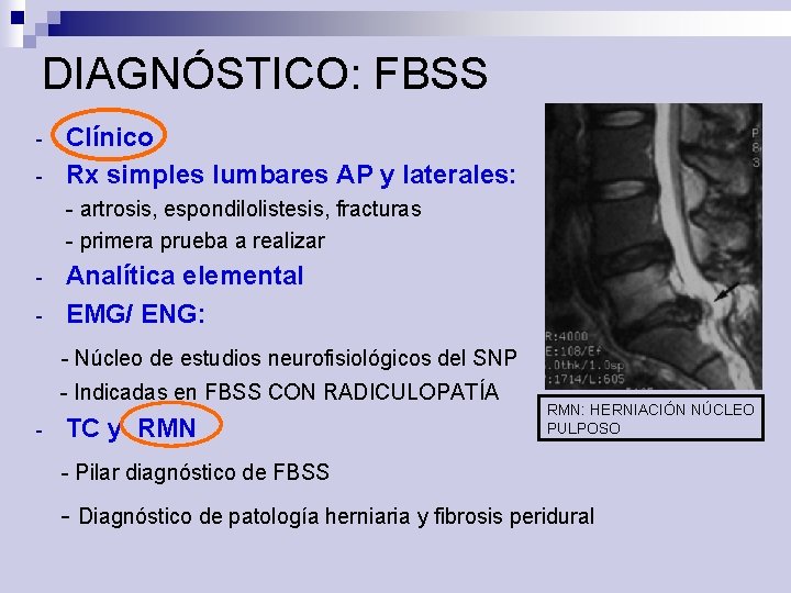 DIAGNÓSTICO: FBSS - Clínico Rx simples lumbares AP y laterales: - artrosis, espondilolistesis, fracturas