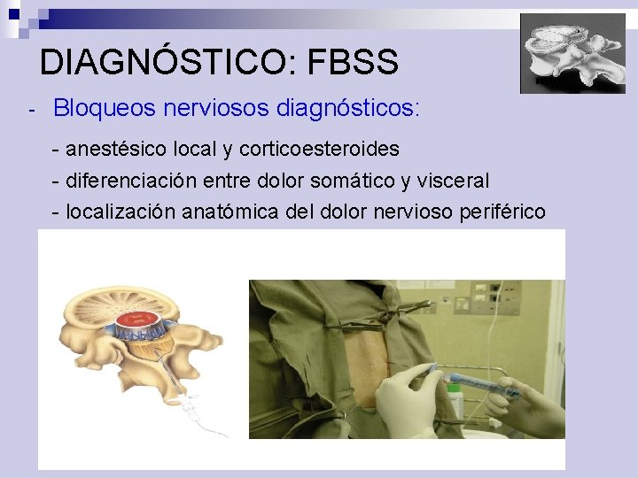 DIAGNÓSTICO: FBSS - Bloqueos nerviosos diagnósticos: - anestésico local y corticoesteroides - diferenciación entre