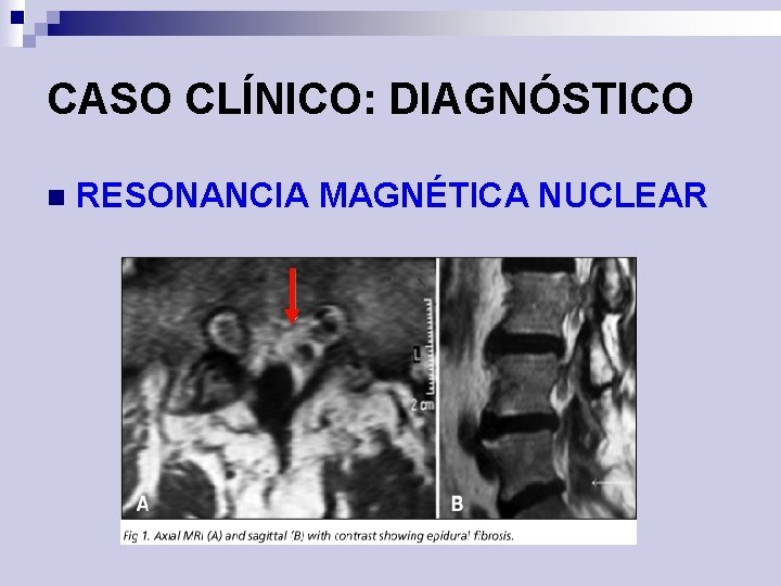 CASO CLÍNICO: DIAGNÓSTICO n RESONANCIA MAGNÉTICA NUCLEAR 