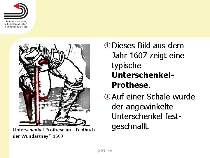 Unterschenkel-Prothese im „Feldbuch der Wundarzney“ 1607 Dieses Bild aus dem Jahr 1607 zeigt eine