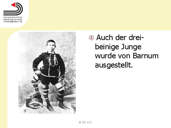  Auch der drei- beinige Junge wurde von Barnum ausgestellt. © ISL e. V.