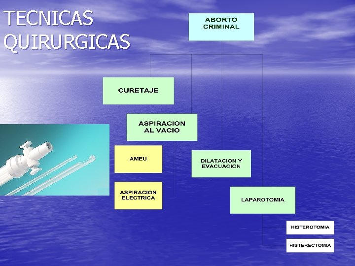 TECNICAS QUIRURGICAS 