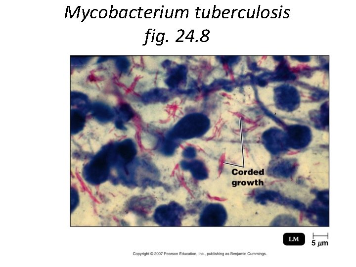 Mycobacterium tuberculosis fig. 24. 8 