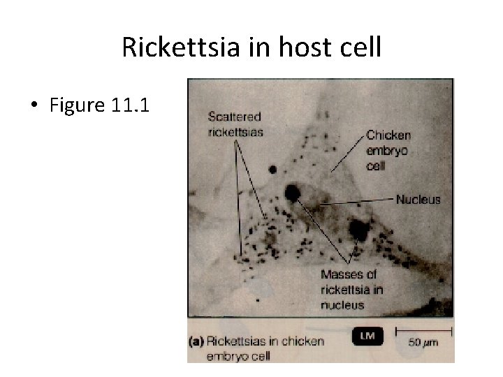 Rickettsia in host cell • Figure 11. 1 