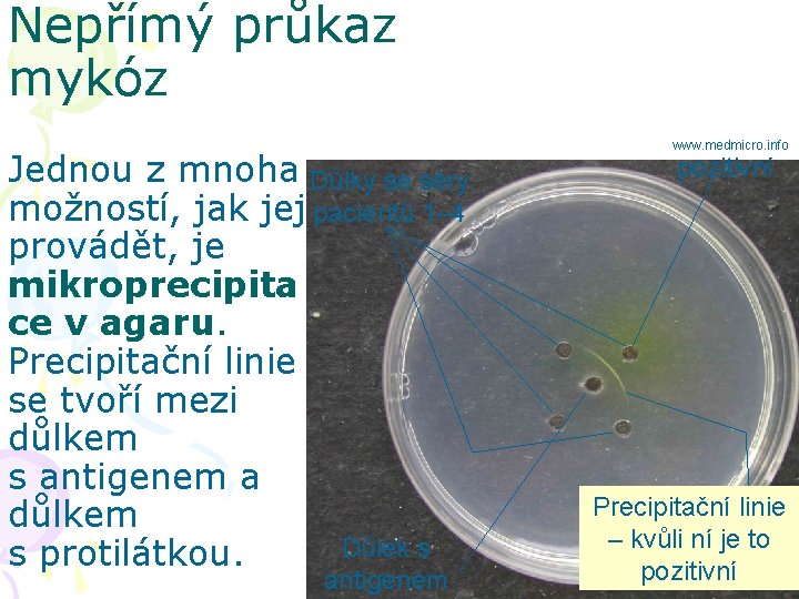 Nepřímý průkaz mykóz Jednou z mnoha Důlky se séry možností, jak jej pacientů 1–