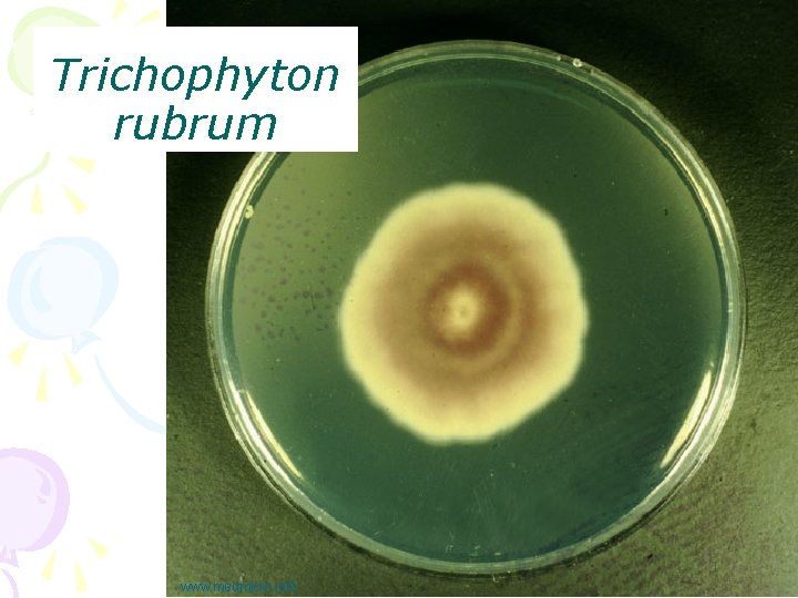 Trichophyton rubrum www. medmicro. info 